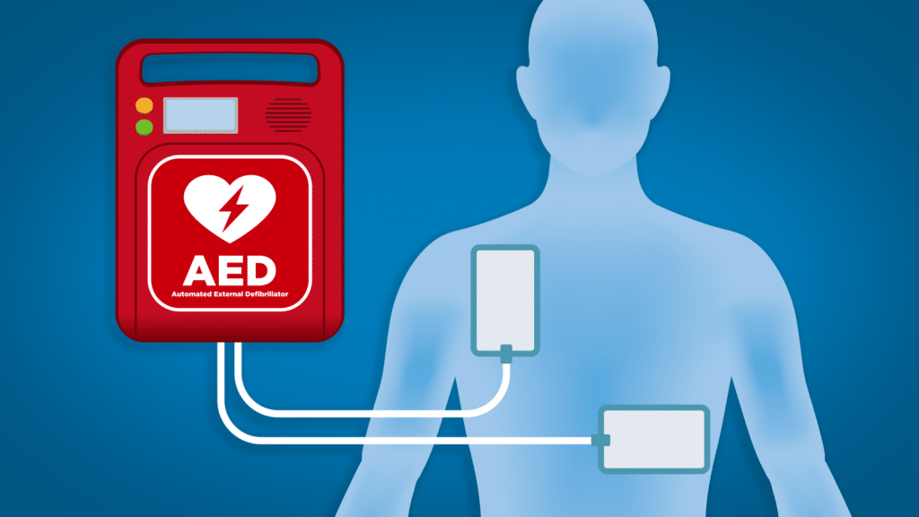 automated external defibrillator