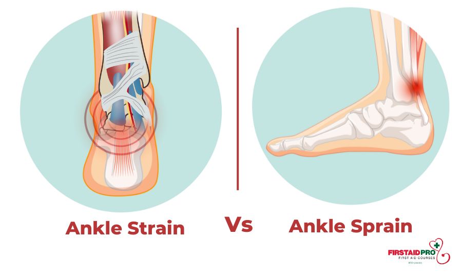 ankle strain and ankle sprain