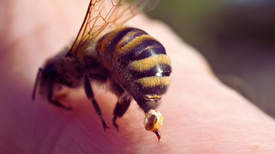Bee sting treatment