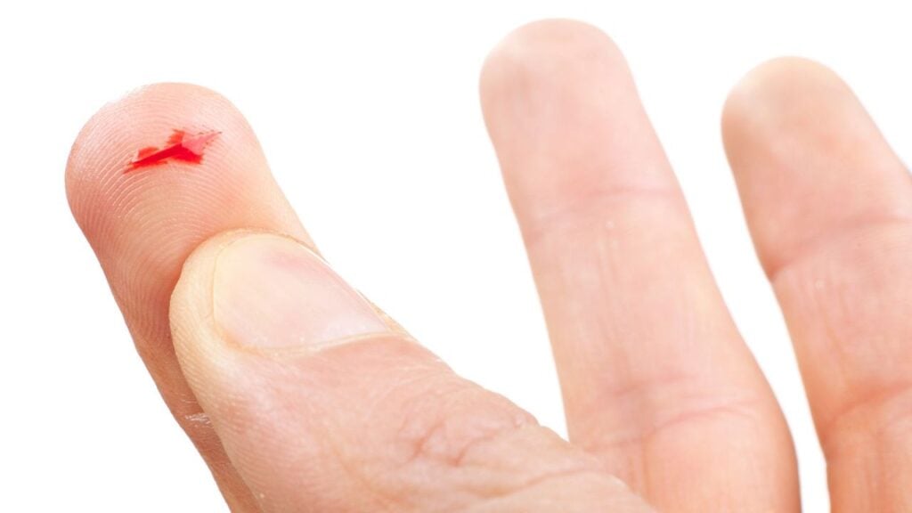 Small Sharp Cut Small Cuts Why Proper Care Still Matters