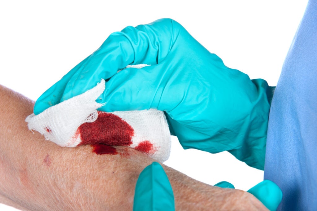 how to dress a deep cut How to Clean an Open Wound: Essential First Aid Knowledge
