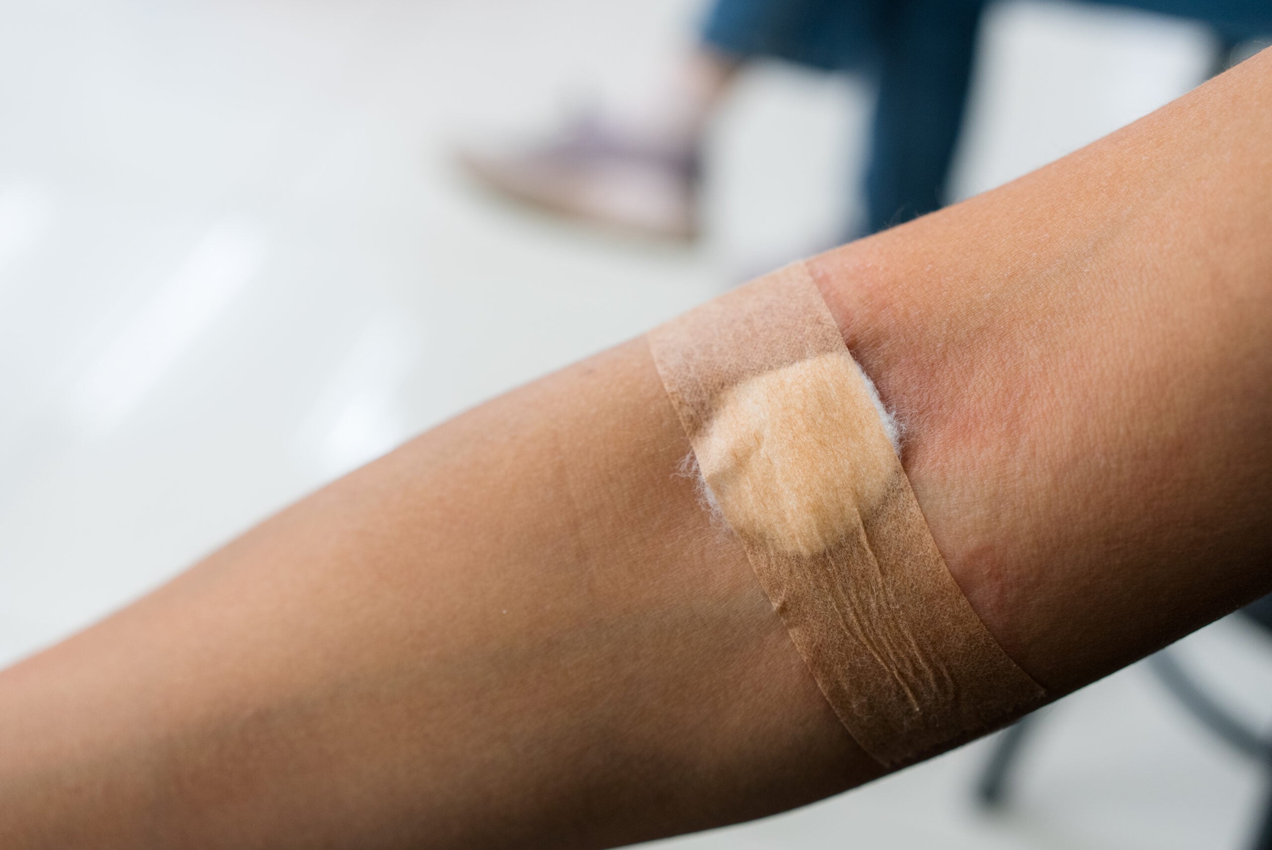 Plaster and cotton on woman arm after blood testing or blood donation