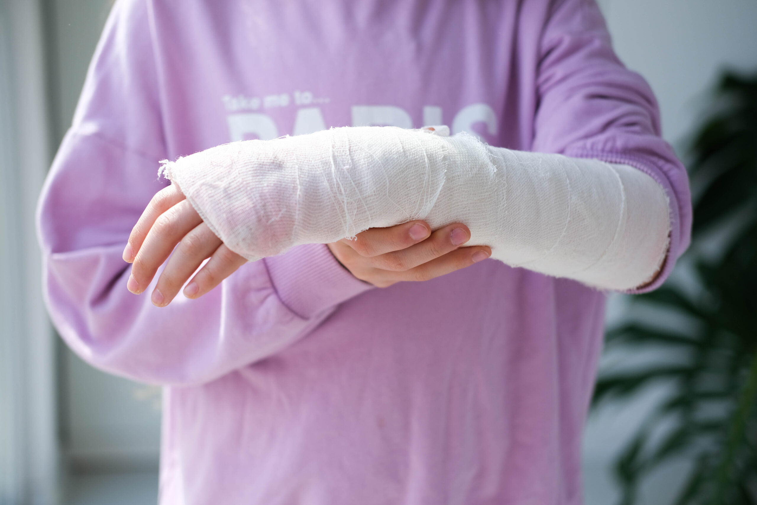 Close-up of a broken arm of a child in a cast. The girl holds her hand folded against. A child with a plaster on his hand