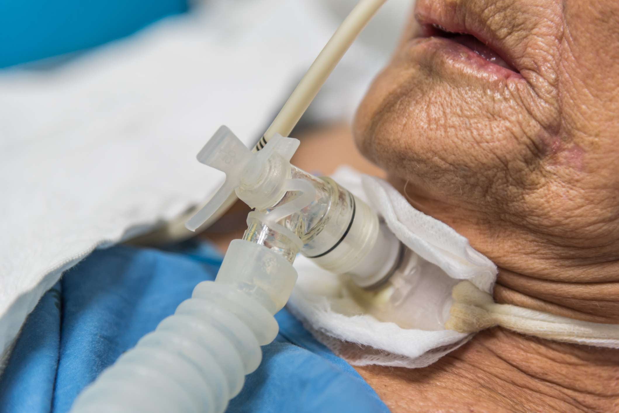 Online Tracheostomy Support Training