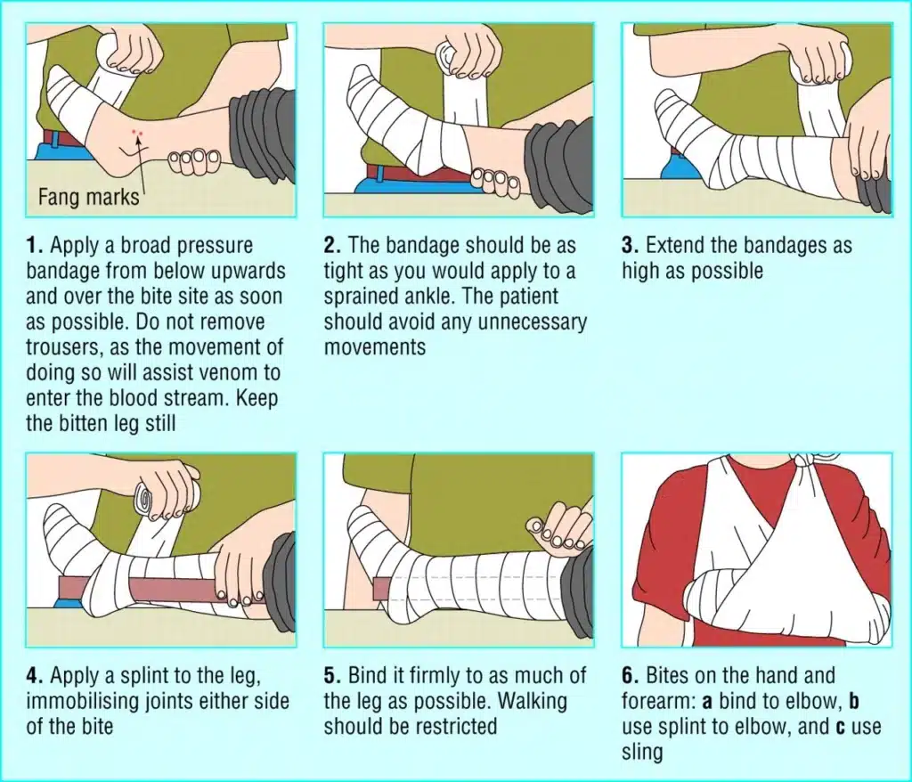 How to Apply a Pressure Immobilisation Bandage