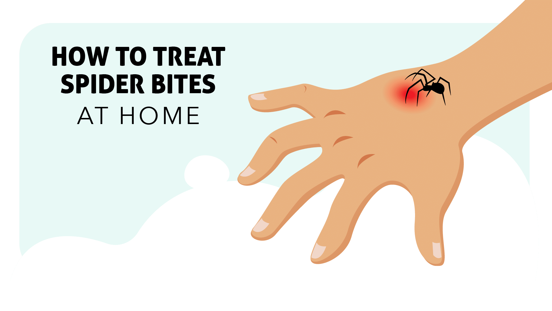spider-bite-treatment