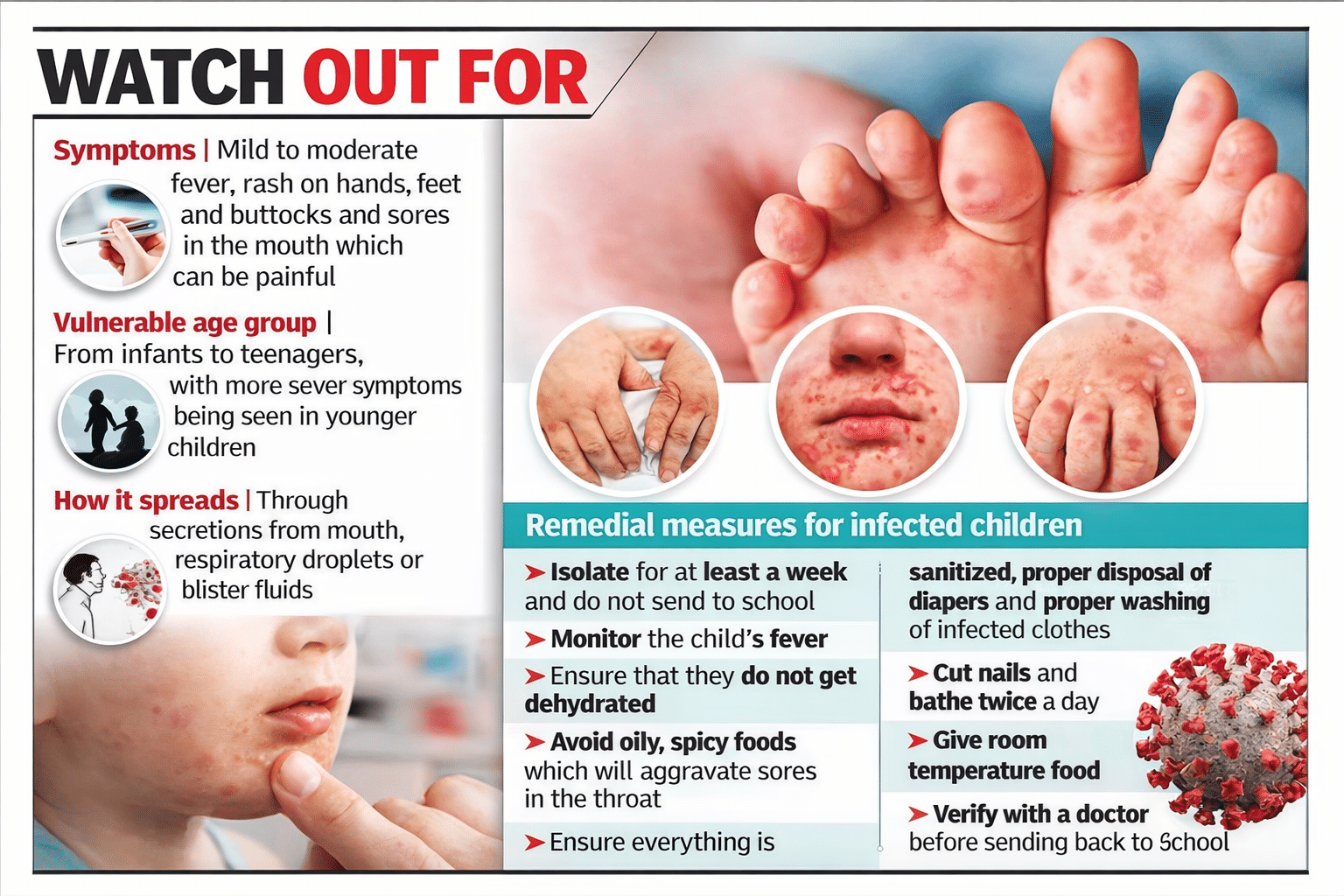 Hand foot and mouth disease signs and treatment