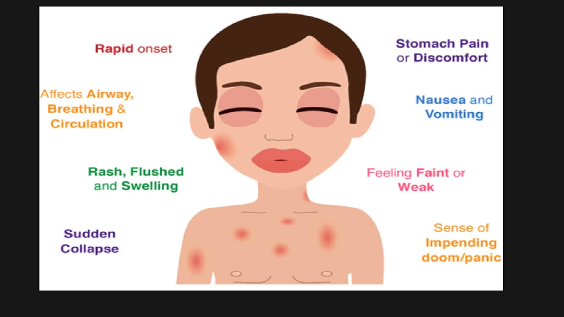 signs and symptoms of anaphylaxis
