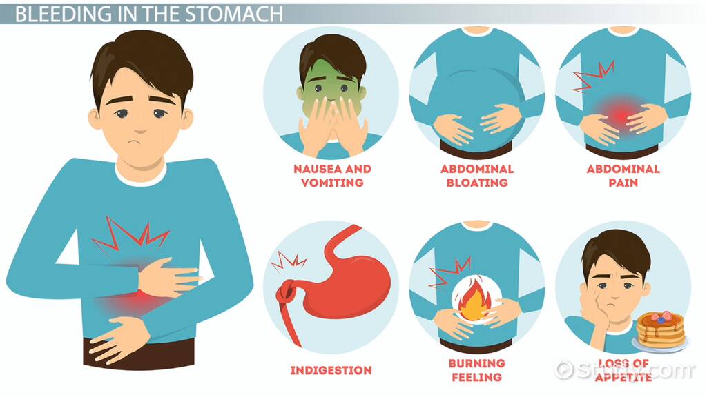 bleeding internally - symptoms